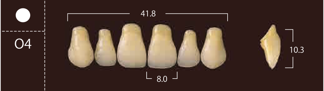 Soluut PX Anterior Upper - Shades A4; B2 - B4