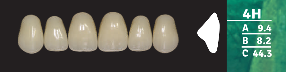 Biodent Upper Anterior - Shades B2- B3