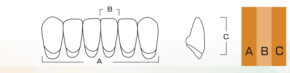 Crown PX Lower Anterior - Shades A1 - A3.5