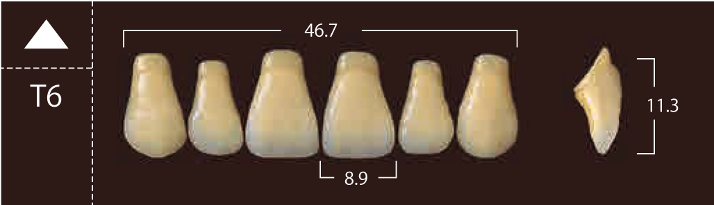 Soluut PX Anterior Upper - Shades A4; B2 - B4