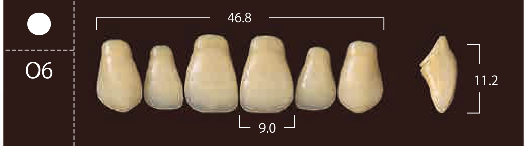 Soluut PX Anterior Upper - Shades A4; B2 - B4