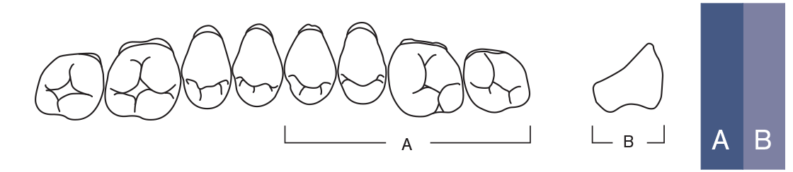 Flat AC Upper Posterior - Shades A1 - A3.5