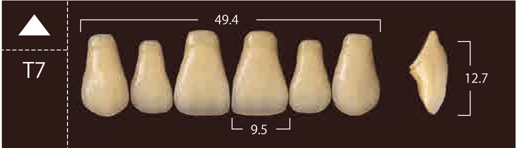 Soluut PX Anterior Upper - Shades A4; B2 - B4
